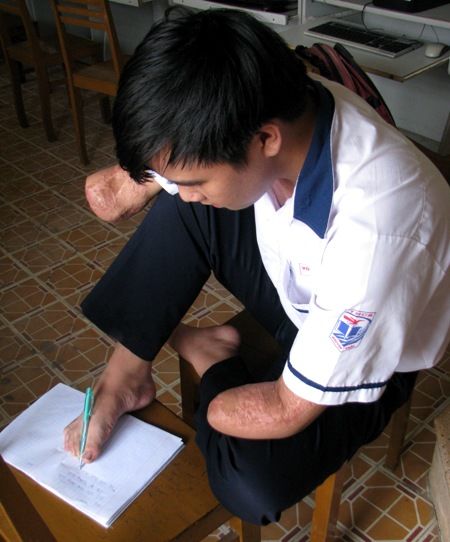 khuyet tat, tai nan, viet bang chan, giao duc, vuot kho, hoc sinh, dan tri khuyet tat, tai nan, viet bang chan, giao duc, vuot kho, hoc sinh, dan tri