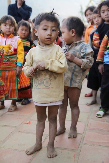 chong_choi_troi_ret_hoc_sinh_vung_kim_bon.jpg