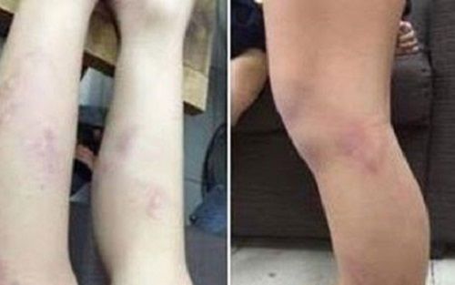 Cô giáo đánh 11 học sinh, Chủ tịch vào cuộc làm rõ - Ảnh 2