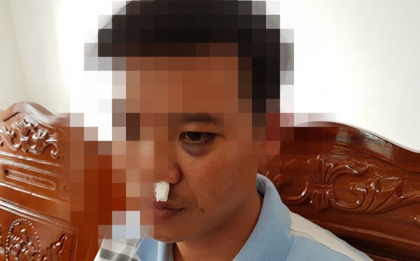 Học sinh dẫn người lạ vào trường đánh thầy giáo nhập viện để trả thù